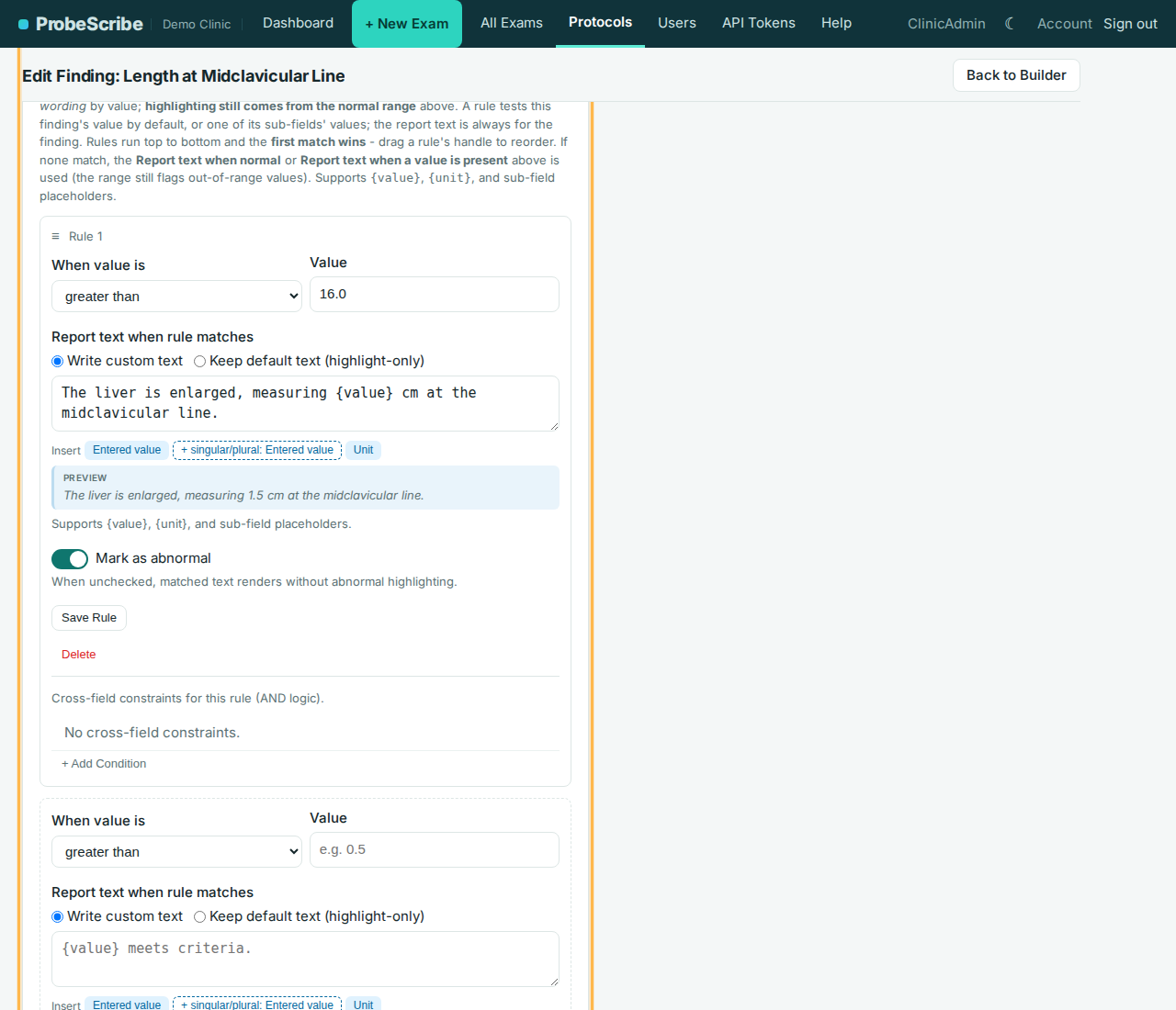 Advanced Rules card on the finding editor with a numeric comparison rule