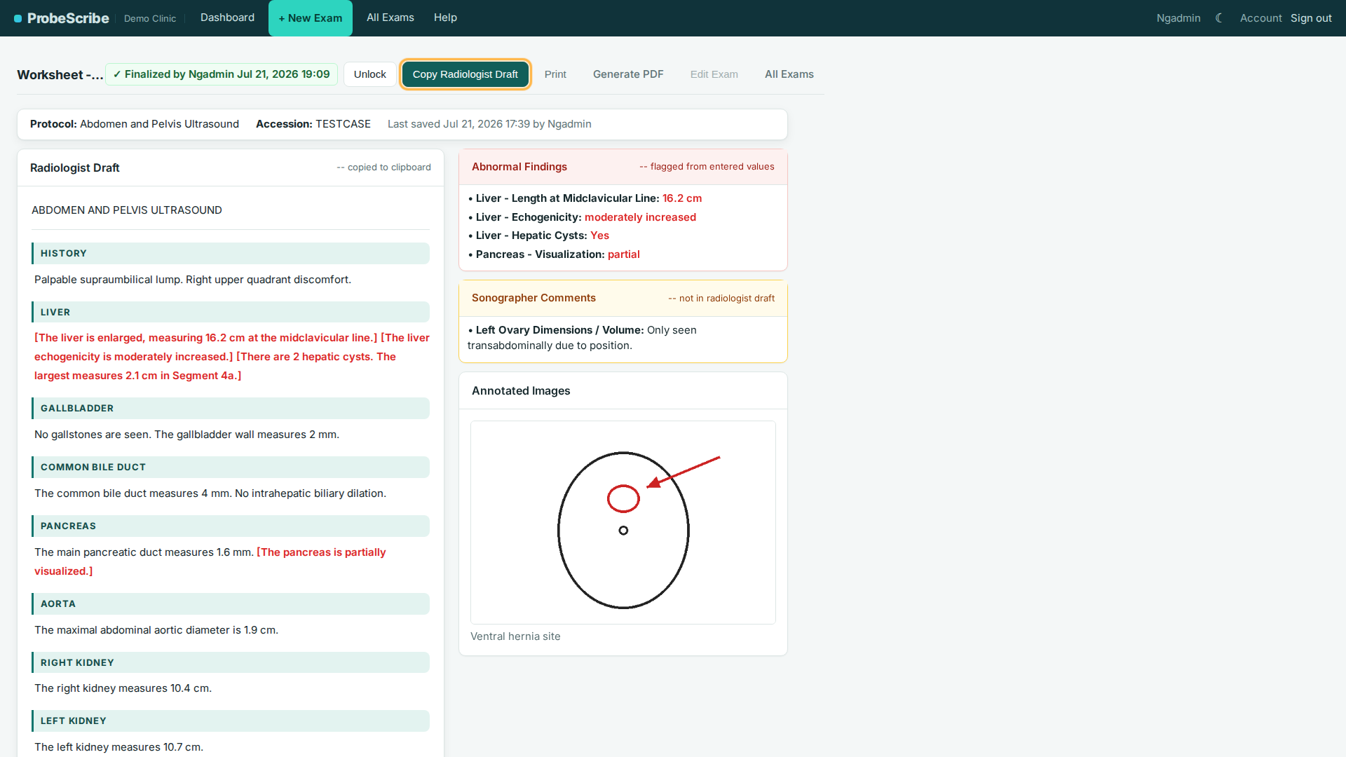ProbeScribe report screen with Copy Radiologist Draft button