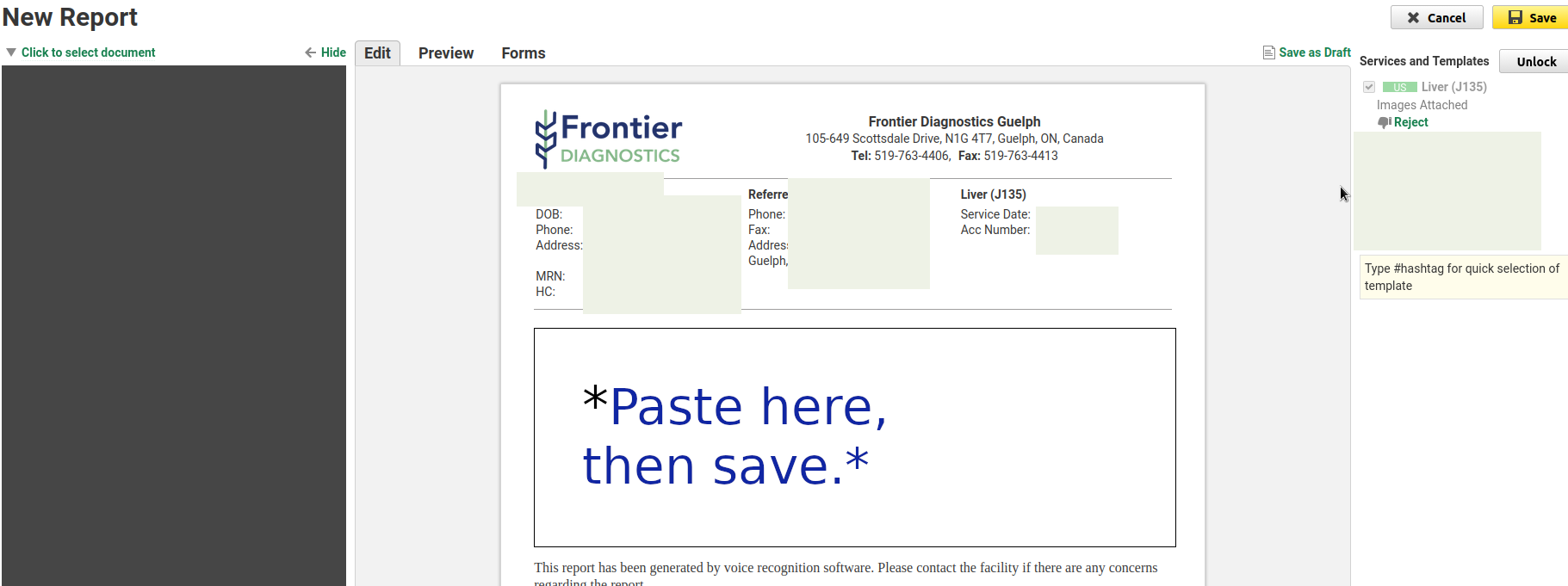 Velox report editor with paste area highlighted